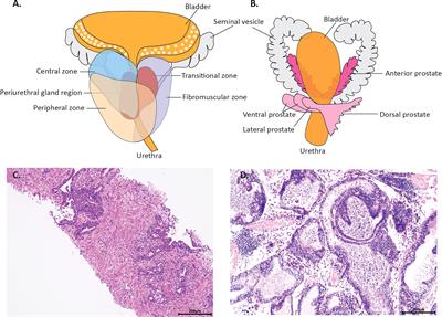 Preclinical models and evaluation criteria of prostatitis